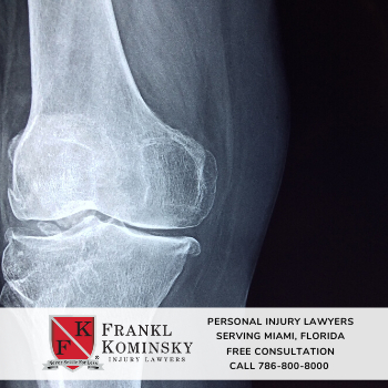 Miami Personal Injury Lawyers