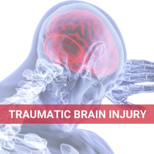 Pompano Beach Traumatic Brain Injury Lawyers Frankl Kominsky 954-800-8000