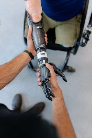 Prosthetic Arm