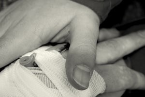 Child Injuries