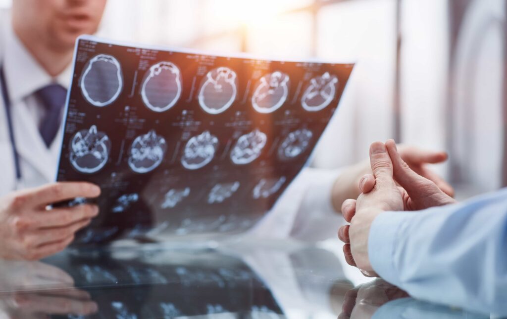 Doctor reviewing brain scan MRI results with a patient during medical consultation.